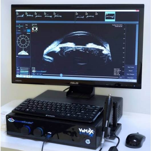 Vumax UBM
